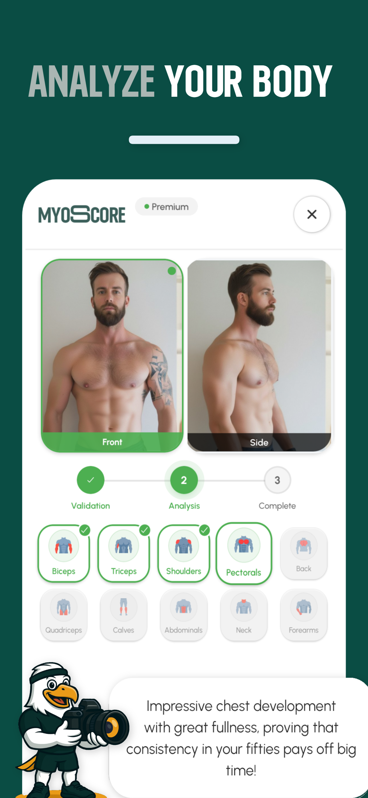 Écran d'analyse de photo MyoScore